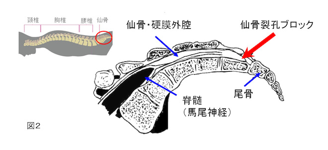 仙骨裂孔ブロック注射